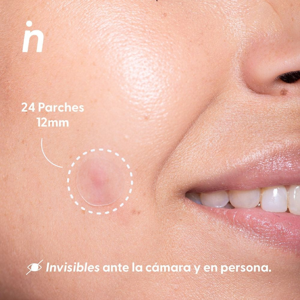 Imagen 2